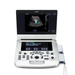 PORTABLE ULTRASOUND